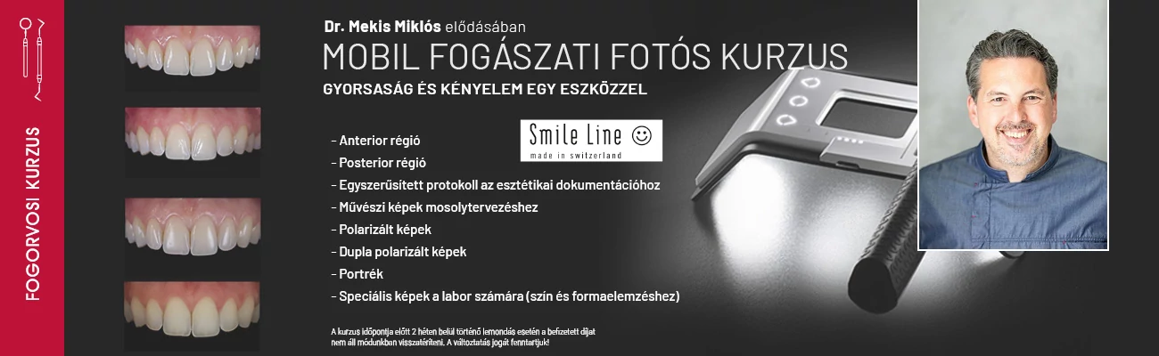 Mobil fogászati fotós kurzus