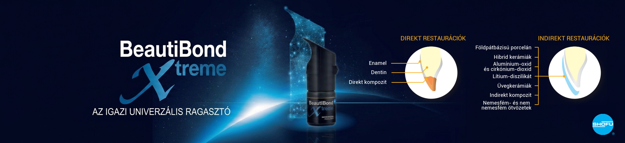 Shofu BeautiBond Xtreme