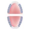 Kép 2/3 - American Eagle Scaler N-1 Anterior XPX