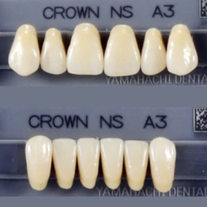 Crown NS Acryl Anterior