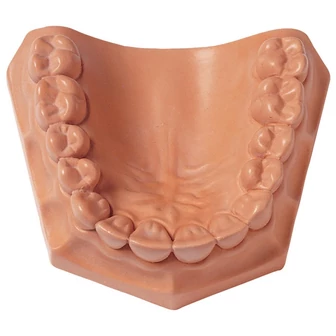 Whip Mix Snap Stone gipsz 15kg