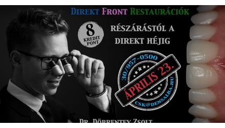 Ott voltunk a Direkt front restaurációk kurzuson