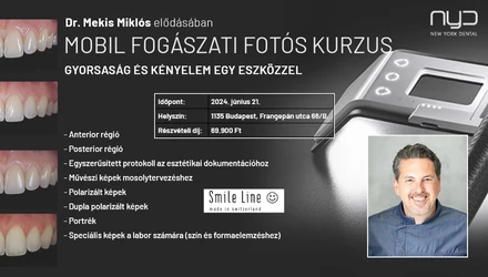 Mobil fogászati fotós kurzus - gyorsaság és kényelem egy eszközzel!