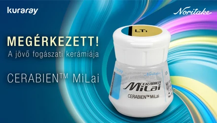 CERABIEN™ MiLai - Ultravékony rétegzés