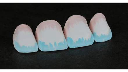 A dynamic duo for natural-looking, functional restorations