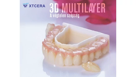 Természetes esztétika és megbízható szilárdság egyetlen cirkóniában – XTCERA 3D Multilayer Zirconia