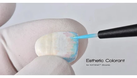 Kuraray Noritake - Esthetic Colorant: Hatékony eljárás az élethű eredményért