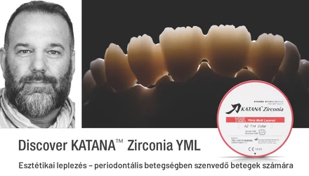 Fedezze fel a Katana Zirconium YML-t