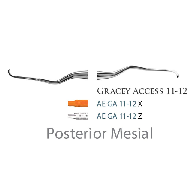 Fogászati műszer Gracey +3 Access 11-12 Posterior Mesial, with stainless steel handle 39  fém nyéllel