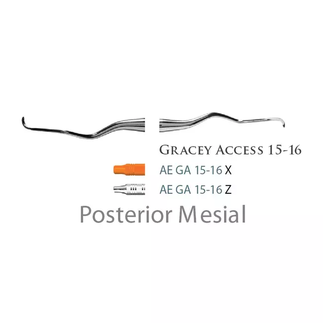 Fogászati műszer Gracey +3 Access 15-16 Posterior Mesial, with stainless steel handle 39  fém nyéllel