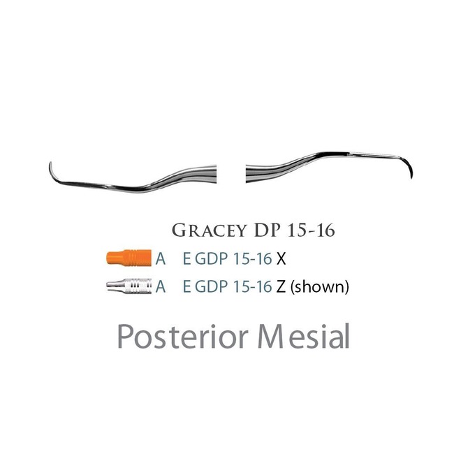 Fogászati műszer Gracey +3 Deep Pocket 15-16 Posterior Mesial, with stainless steel handle 39  fém nyéllel
